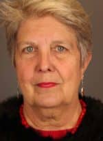 Facial Rejuvenation Before and After Photos