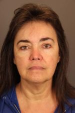 Facial Rejuvenation Before and After Photos