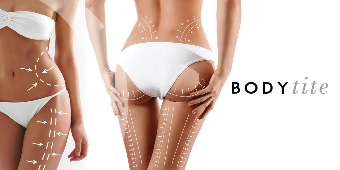 BodyTite