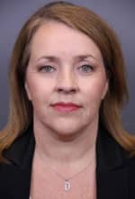 Timeless Lift Before and After Photos