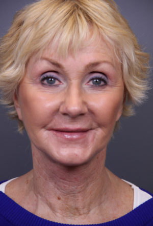 timeless plastic surgery timeless plastic surgery